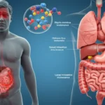 Detailed medical illustration showing histamine intolerance symptoms including bloating, headaches, and fatigue with labeled digestive system